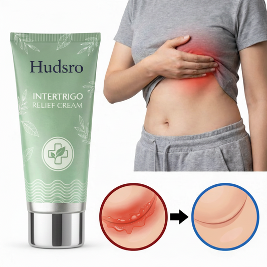 Intertrigo Creme  - Hudsro™ Hurtig Lindring